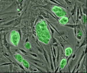 Diabetes Cure - Adult Stem Cells or Embryonic Stem Cells