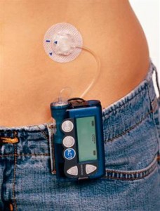 Children And Insulin Pumps