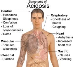 Lactic Acidosis