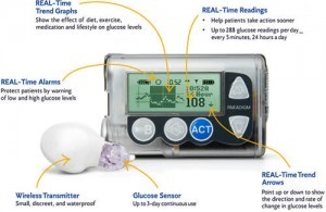 Minimed Paradigm 722 Insulin Pump