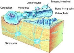 bone cells and diabetes