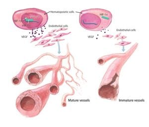 Diabetes - The Cause Of Blood Vessel Damage