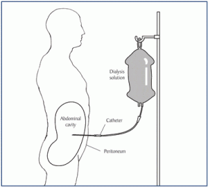 HbA1C Results Prove Inaccurate For Dialysis Patients