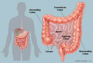 Study Links Diabetes with Increased Colon Cancer Risk