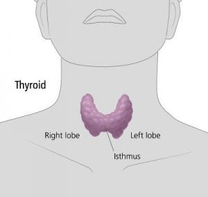 Type 2 Diabetes Associated with Increased Risk of Thyroid Cancer