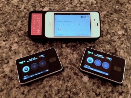 The Bionic Pancreas